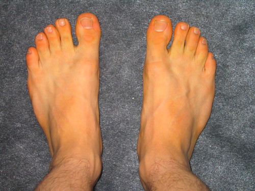 Blue and Green Bash To Benefit Back On My Feet